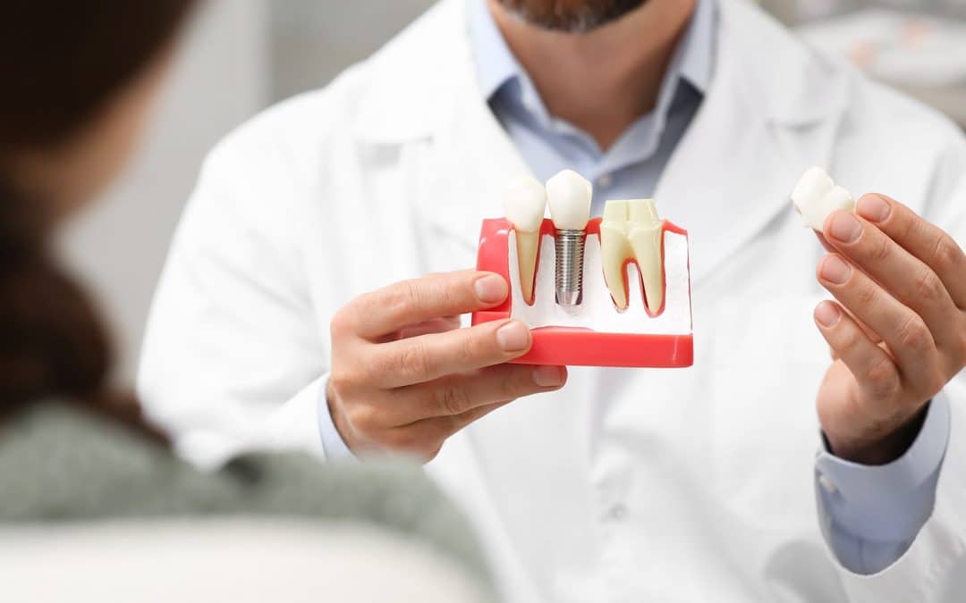 When Does a Tooth Need a Crown and What Does the Treatment Process Look Like?